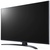 LG 43UP81006LA