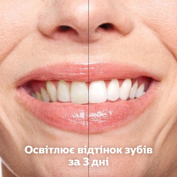 Philips Sonicare DiamondClean Smart 9400 HX9917/88